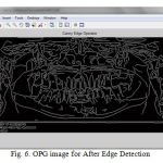 Fig. 6. OPG image for After Edge Detection