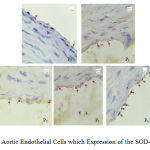 Figure 4. Aortic Endothelial Cells which Expression of the SOD-3 Positive