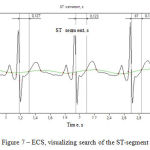 Figure 7 – ECS, visualizing search of the ST-segment