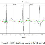 Figure 8 – ECS, visualizing search of the ST-interval