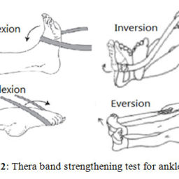 Effect of Friction Technique on Ankle Sprain Grade II Treatment ...