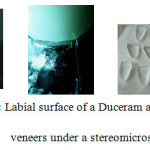 Figure 1: Labial surface of a Duceram and a Inceram veneers under a stereomicroscope