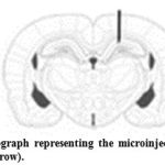 Figure 1. Schematic photograph representing the microinjection site of Amyloid β into the hippocampus (black arrow).