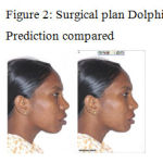 Figure 2: Surgical plan Dolphin Prediction compared