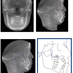 3d Imaging and its Implications in Orthodontics.- A review – Biomedical ...