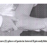 Figure 2: place of pain in lateral Epicondylitis