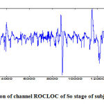 Fig 2 Extraction of channel ROCLOC of So stage of subject sdb1