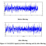 Figure 4: C4A1(EEG signal) (a) before filtering and (b) after filtering
