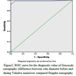 Figure 2: ROC curve for the diagnostic value of Grayscale sonography (difference between vein diameter before and during Valsalva maneuver compared Doppler sonography in patients with varicocele (n=92).