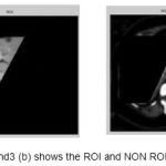 Figure 3 (a) and3 (b) shows the ROI and NON ROI image