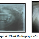 Figure 5: Orthopantomograph and Chest Radiograph –No Abnormalities Detected