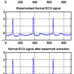 Figure 3: ECG signals for before applying the steganography operation and after the steganography operation as well as after extracting the hidden data.