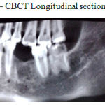 Figure 2: Cbct Longitudinal Section