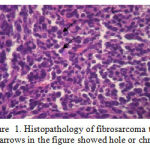 Figure 1: Histopathology of fibrosarcoma tissue