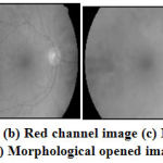 Figure 4: (a) Retinal Image (b) Red channel image (c) Morphological closed image (d) Morphological opened image