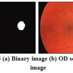Figure 5: (a) Binary image (b) OD segmented image