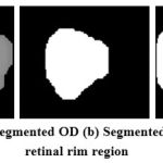 Figure 6: (a) Segmented OD (b) Segmented OC (c) Neuro retinal rim region
