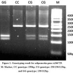 Figure 1: Genotyping result for adiponectin gene rs266729. M: Marker, CC genotype: 250bp, CG genotype: 250/138/112bp, and GG genotype: 138/112bp.