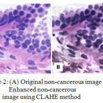 Figure 2: (A) Original non-cancerous image and (B) Enhanced non-cancerous image using CLAHE method