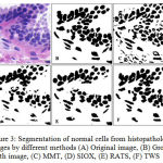 Figure 3: Segmentation of normal cells from histopathology images by different methods (A) Original image, (B) Ground truth image, (C) MMT, (D) SIOX, (E) RATS, (F) TWS