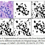 Figure 4: Segmentation of cancerous cells from histopathology images by different methods (A) Original image, (B) Ground truth image, (C) MMT, (D) SIOX, (E) RATS, (F) TWS