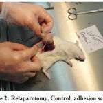 Figure 2: Relaparotomy, Control, adhesion score: 4