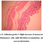Figure 4: Adhesion grade 2: Slight increase of monocytes and inflammatory cells, mild fibroblast accumulation,mild neovascularization.