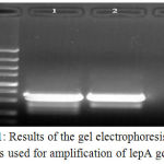 Figure 1: Results of the gel electrophoresis of PCR products used for amplification of lepA gene of L.