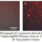 Figure 3: A – Micrograph of a monocyte derived dendritic cells infected with the EF1alpha-tagRFP-NP-puro virus A- Vpx negative virions, B- Vpx positive virions