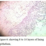 Figure 6: showing 8 to 10 layers of lining epithelium.