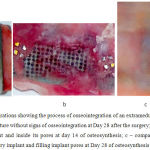Figure 1: Anatomic preparations showing the process of osseointegration of an extramedullary plate