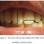 Figure 2: The intra oral are the length and width of the maxillary central incisor.