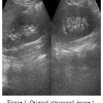 Figure 1: Original ultrasound image 1