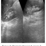 Figure 2: Original ultrasound image 2