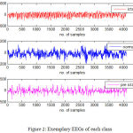 Figure 2: Exemplary EEGs of each class