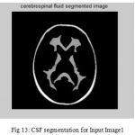 Figure 13: CSF segmentation for Input Image1