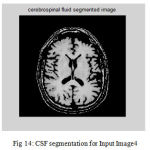 Figure 14: CSF segmentation for Input Image4