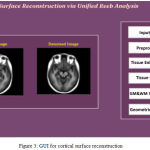 Figure 3: GUI for cortical surface reconstruction