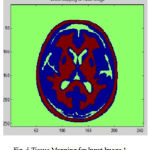 Figure 5: Tissue Mapping for Input Image 1
