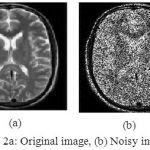Figure 2a: Original image, (b) Noisy image