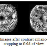 Figure 3: Images after contrast enhancement and cropping to field of view