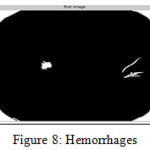 Figure 8: Hemorrhages