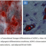 Figure 2: Capacity of mesodermal lineages differentiation of ADSCs, when ADSCs exposed to osteogenic and adipogenic differentiation conditions, ADSCs clones maintain osteogenic(Alizarin red)(A), and adipose(Oil red O)(B)
