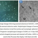 Figure 3. Morphologic changes following neuronal induction of ADASCs. ADSCs after 24 h of culture with neuronal induction media.