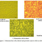 Figure 2: Mononuclear cells, Breast and prostate cancer cells in culture