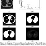 Figure 2a: Original CT slice and tissues localization, (b) Threshold value selections based on histogram, (c) global threshold of (a), (d) Initial mask of lung region after removing background, fat, muscle, and CT bed, and mask after filling holes but it contains juxta-pleural nodules.(e) final mask after contour correction, (f) segmented lung region extraction