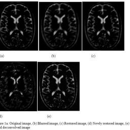 Deblurring of MRI Image Using Blind and Non-Blind Deconvolution Methods ...