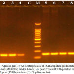 Figure 1: Agarose gel (1.5 %) electrophoresis of PCR amplified products for mex B gene. Lane (M): l00 bp ladder, Lane (1-8): positive result with positive bands of mex B gene (150) bpandlane (C): Negative control.