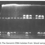 Figure 1: The Genomic DNA isolates from blood samples.