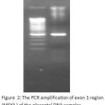 Figure 2: The PCR amplification of exon 1 region (MSX1 ) of the placental DNA samples.